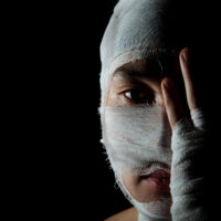 Obverse,Portrait,Of,The,Young,Man,Which,Head,Is,Wound